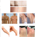 Diodenlaser-Haarentfernungsgerät Laser Dauerhafte Haarentfernung 3 Wellenlängen-6